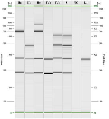 First Detection of Listeria monocytogenes in a Buffalo Aborted Foetus in Campania Region (Southern Italy)